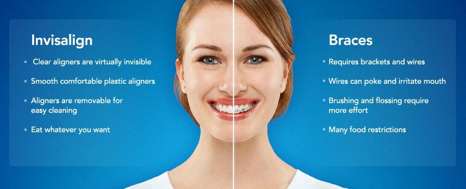 Invisalign Comprehensive Dental Care At Advanced Dentistry In